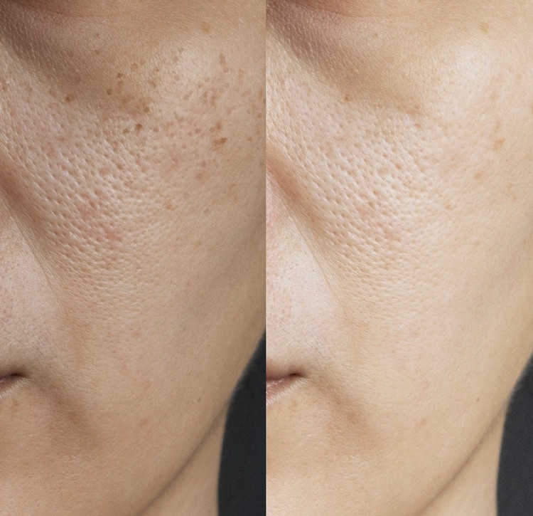 سرم ترمیم کننده پوست حلزون