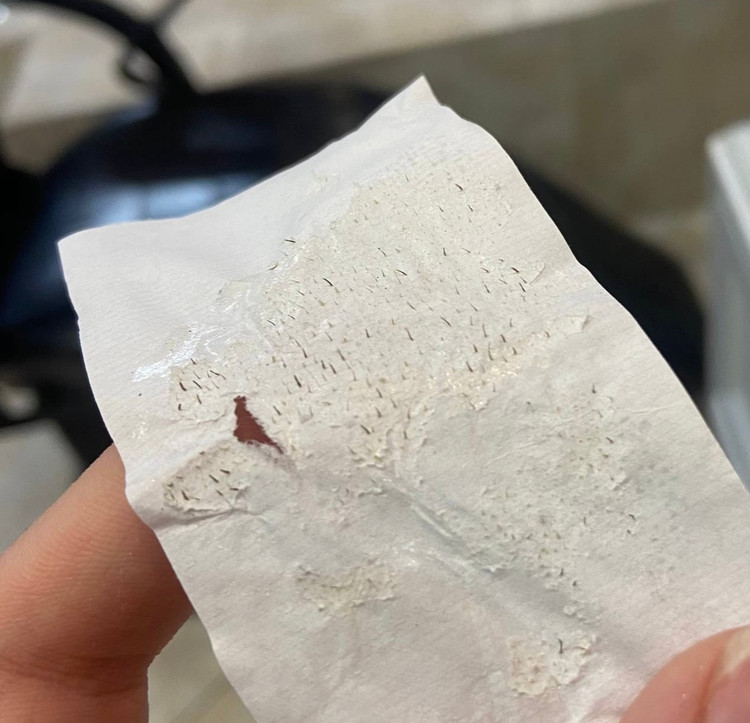 ماسک جوش سرسیاه lanbena