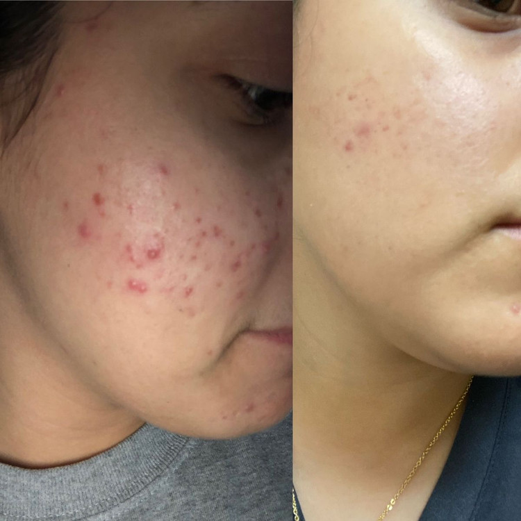 سرم ضدجوش Bioaqua