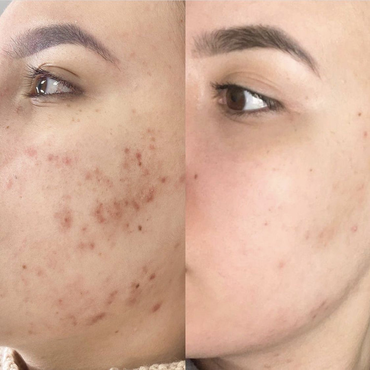 فوم شستشو ضدجوش