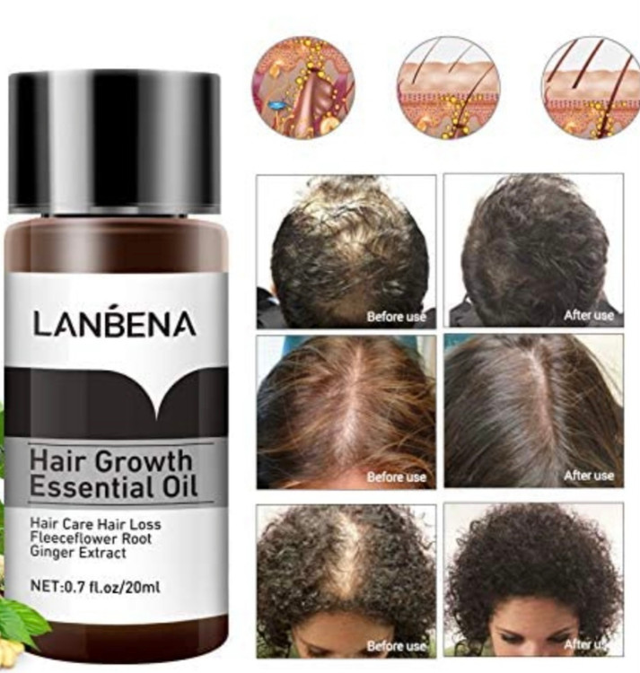 محلول ضدریزش lanbena