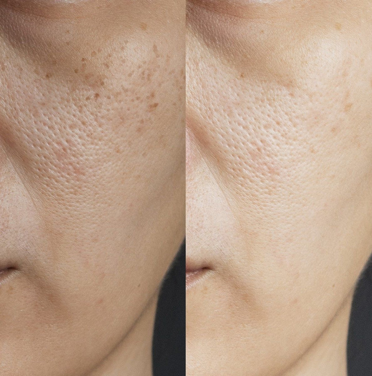 کرم ویتامین سی سادور