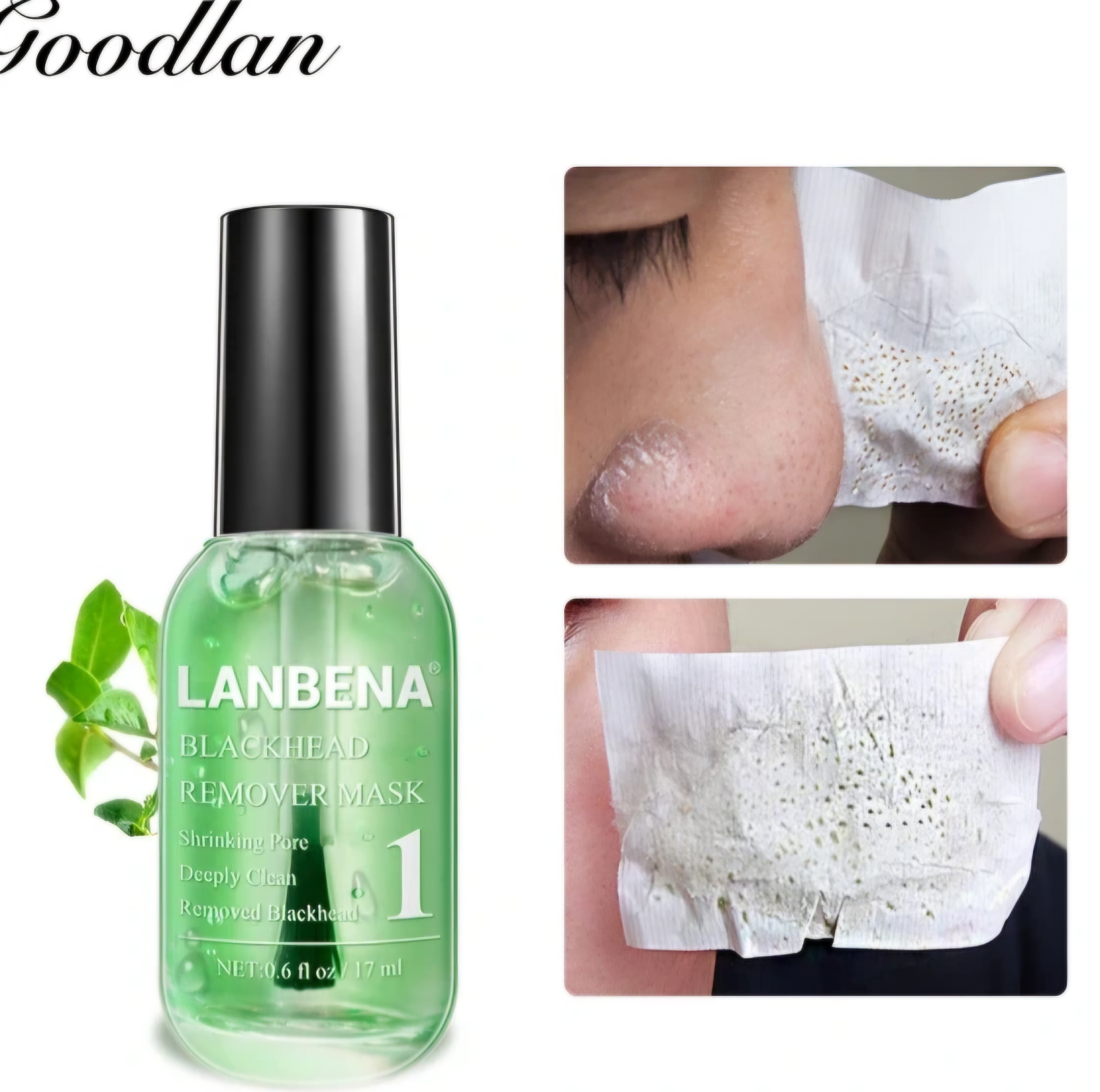 چسب بینی لانبنا مدل لاکی ضدجوش سرسیاه🌱
